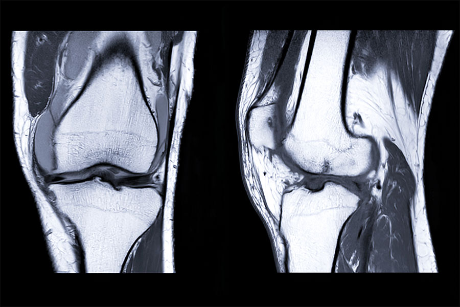 MR görüntüleme, ortopedide kemikleri, kasları, bağ ve tendonları, kıkırdağı ve omurgayı etkileyen bozukluk ve yaralanmaları teşhis için kullanılabilir.