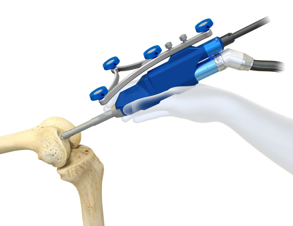 Bursa Robotik Diz Protezi Cerrahisi (Robotik Cerrahi Merkezi)
