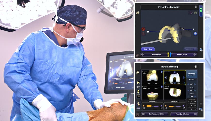 Resim 1. Robotik diz protezi ameliyatı sırasında diz ekleminin 3-boyutlu görüntüleri izlenerek cerrahi plan uygulanır.