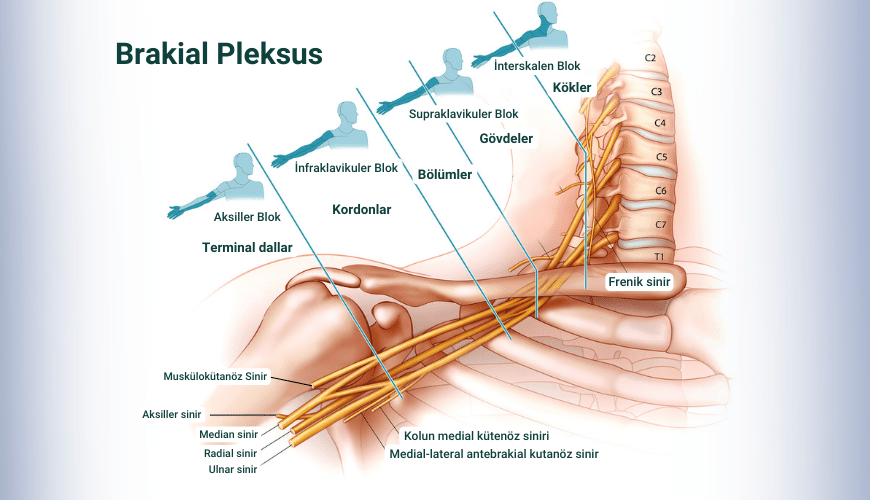 Brakial pleksus sinir bloğunun bölümleri ve enjeksiyon yöntemlerine göre uyuşmanın gerçekleştiği bölgeler
