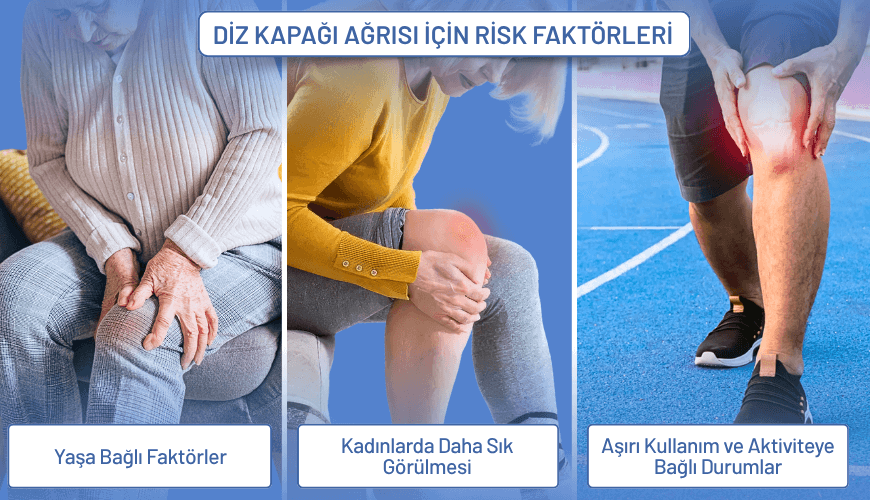 diz kapağı ağrısı için risk faktörleri