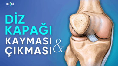 diz kapağı kayması ve çıkması