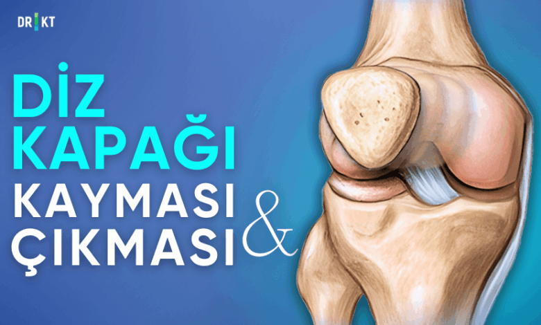 diz kapağı kayması ve çıkması
