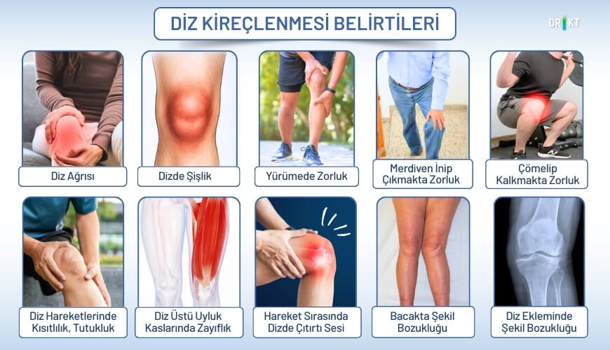 diz kireçlenmesi belirtileri