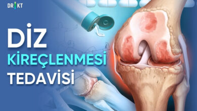 diz kireçlenmesi tedavisi