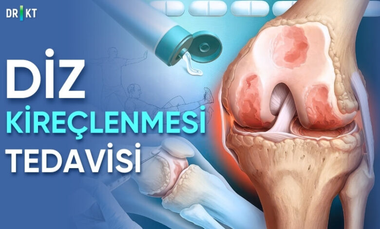 diz kireçlenmesi tedavisi