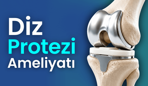 Diz protezi ameliyatı Bursa