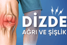 dizde şişlik ve ağrı