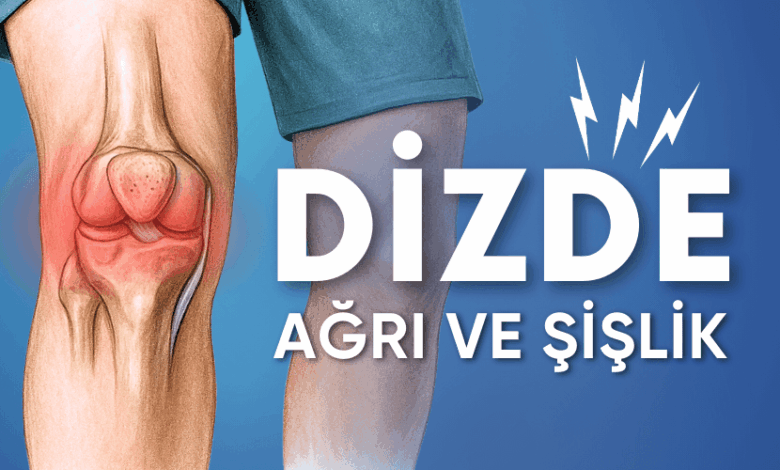dizde şişlik ve ağrı