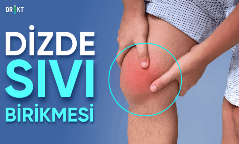 dizde sıvı birikmesi