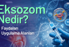 eksozom nedir