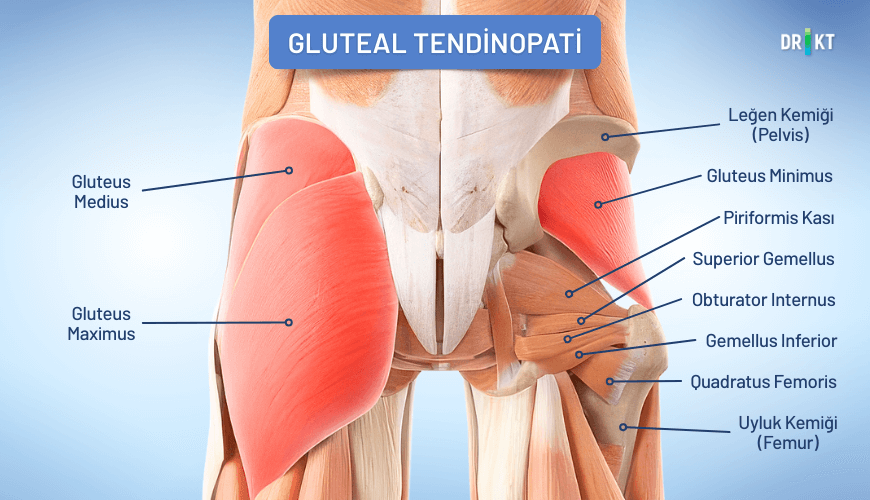Yürüme veya merdiven çıkma gibi aktivitelerle kötüleşen kalça ve bacak ağrısı, tendon yapısının bozulduğu gluteal tendinopatinin bir işareti olabilir.