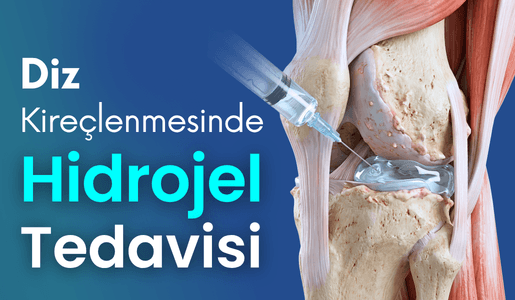 Hidrojel Tedavisi Bursa