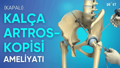 kalça artroskopisi nedir, ameliyatı