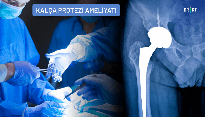 Kalça Çıkığı Tedavisinde Kalça Protezi Ameliyatı