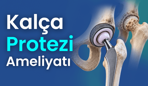 Kalça Protezi Ameliyatı Bursa
