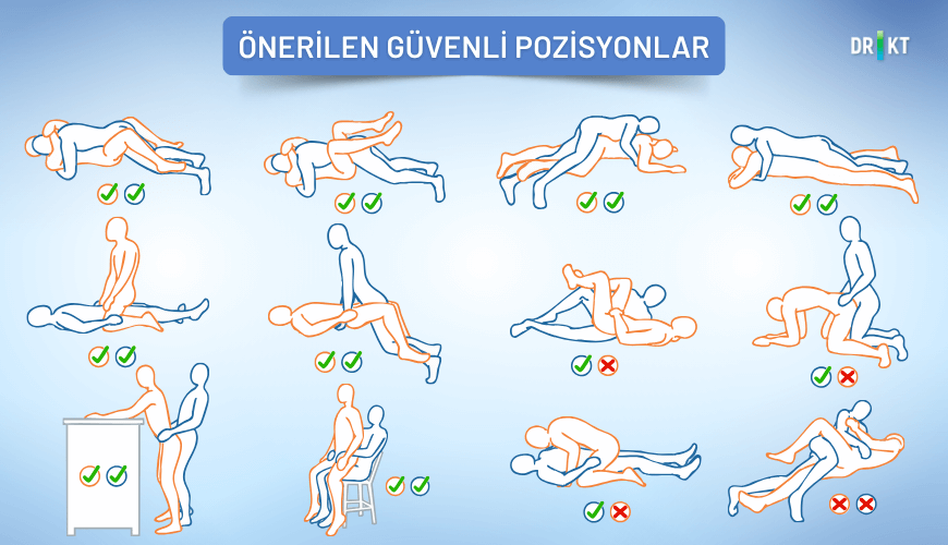 kalça protezi ameliyat sonrası cinsel ilişki pozisyonu 