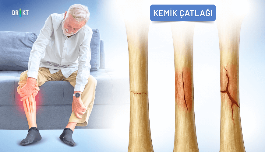 Kemik çatlağı, travma sonrası ortaya çıkan şiddetli kemik ağrısı ve hareket kısıtlılığına yol açabilir.