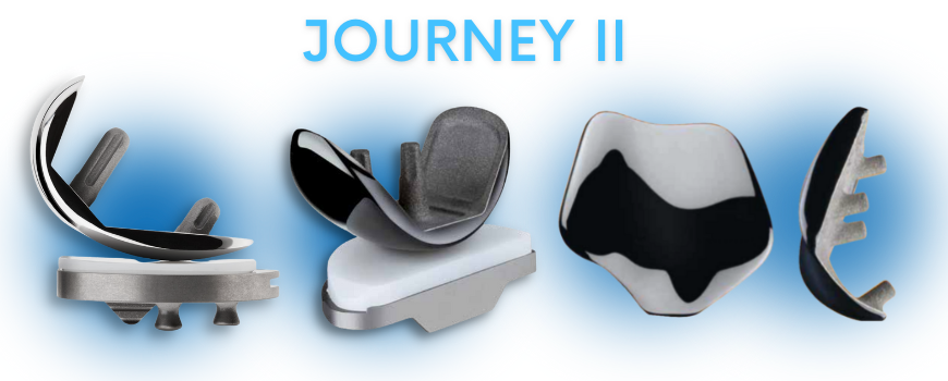Kısmi diz protezi ameliyatımda kullanılan protezin markası- Journey II