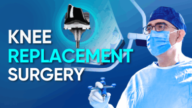 knee replacement surgery