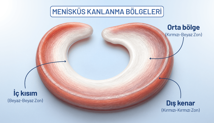 Menisküsün kırmızı-kırmızı, kırmızı-beyaz ve beyaz-beyaz kanlanma bölgeleri