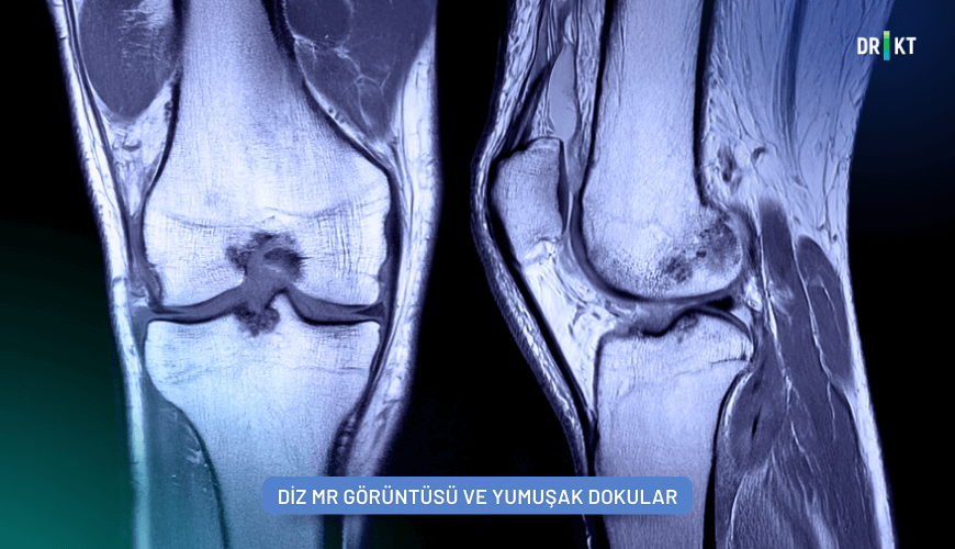 Resim 3. MR görüntüleme, ortopedide kemikleri, kasları, bağ ve tendonları, kıkırdağı ve omurgayı etkileyen bozukluk ve yaralanmaları teşhis için kullanılabilir.