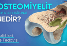 osteomileyit nedir