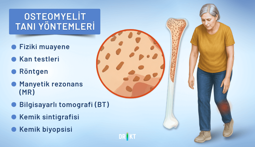 Kemik iltihabı tanısı, çeşitli testler ve osteomyelit radyolojik bulguları yoluyla konulur.
