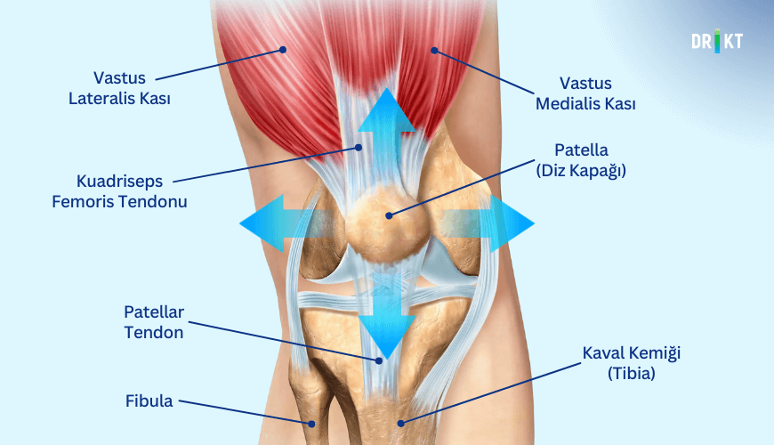  Diz kapağının yanlış hareketi sebebiyle oluşan patellofemoral uyumsuzluk, ön diz ağrısıyla birlikte şişliğe sebebiyet verebilir.