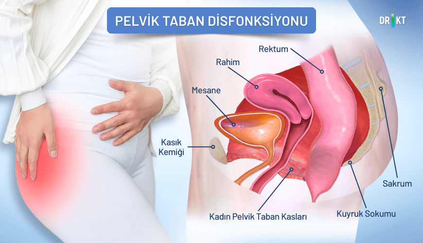 Pelvik taban kaslarının istemsiz kasılması, zamanla kalça ağrısı ve fonksiyonel bozukluklara yol açan pelvik taban disfonksiyonuna neden olabilir.
