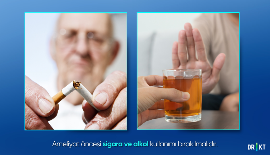 Ameliyat öncesi sigara ve alkol kullanımı bırakılmalıdır.