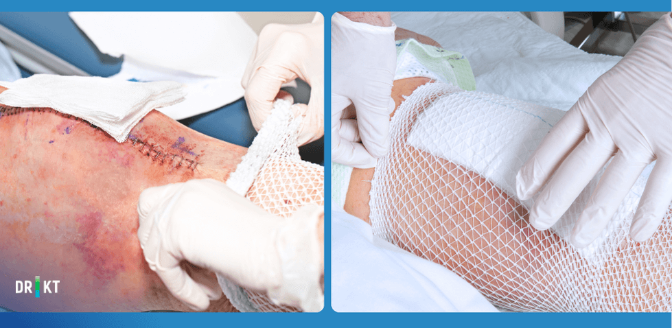 wound care after prosthesis surgery