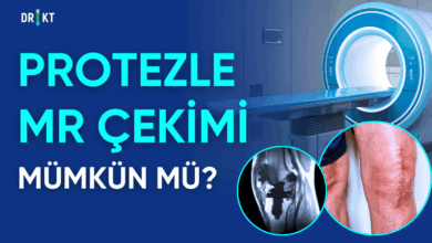 protezle mr çekilir mi