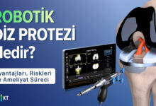 Robotik diz protezi
