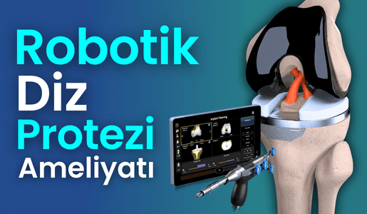 Robotik Diz Protezi Ameliyatı Bursa