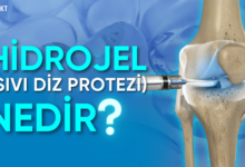 hidrojel sıvı diz protezi