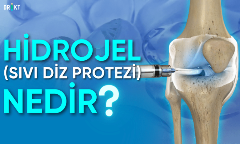 hidrojel sıvı diz protezi