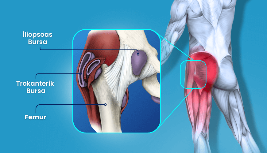 trokanterik bursa - trokanter major