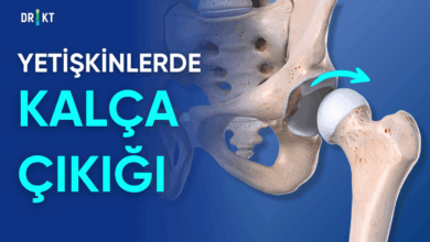 yetişkinlerde kalça çıkığı
