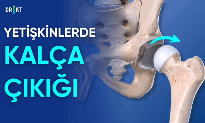 yetişkinlerde kalça çıkığı