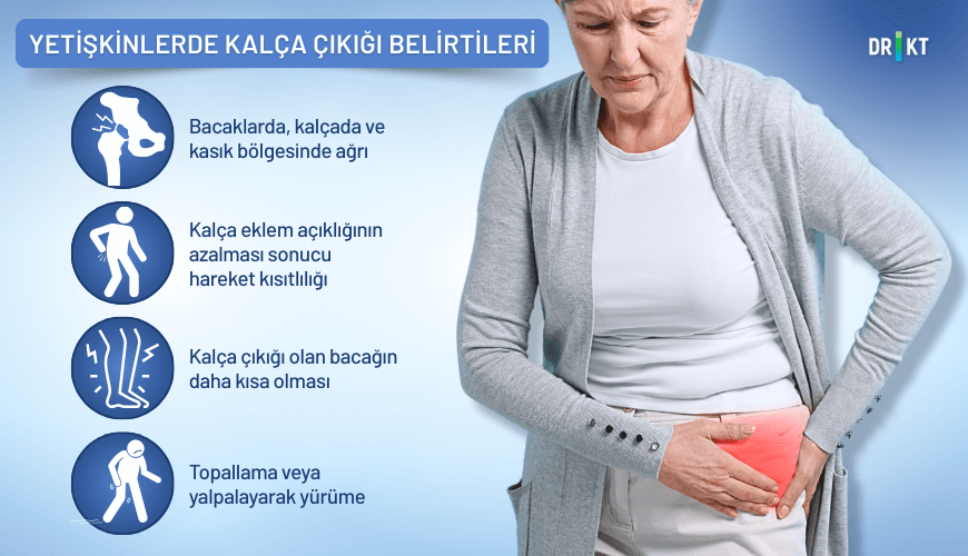 yetişkinlerde kalça çıkığı belirtileri